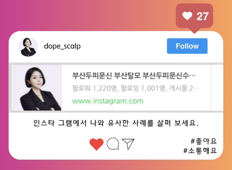 돕스칼프 이미지