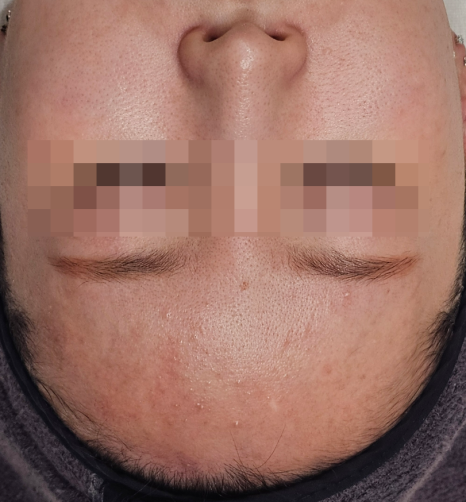 피지메디칼 이미지