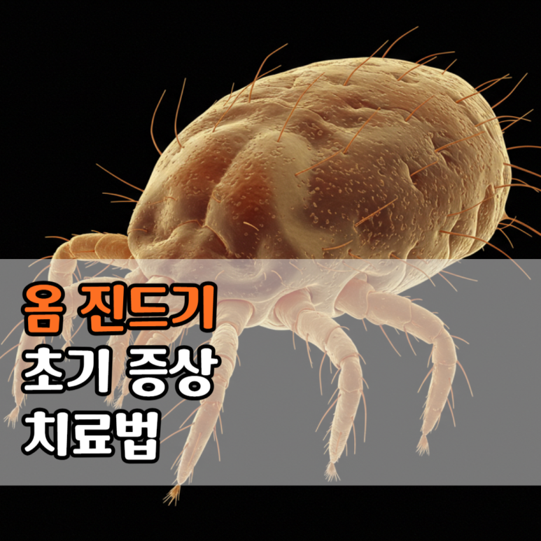 전염성 강한 옴 진드기 초기 증상과 치료법 완치 방법은? : 네이버 블로그