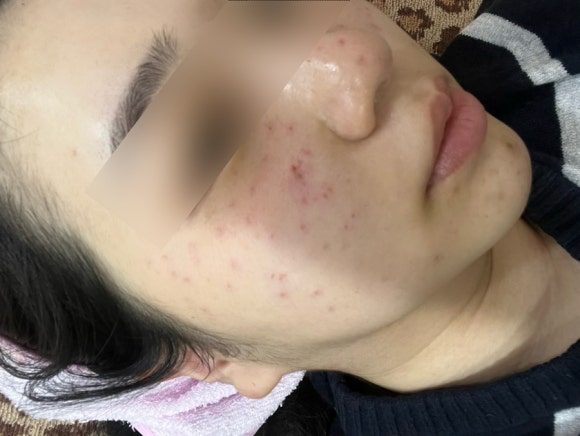 능곡예인의원 이미지