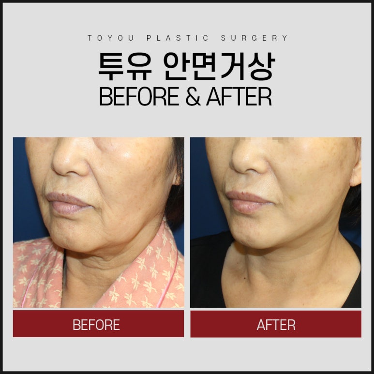 섬세히 이미지