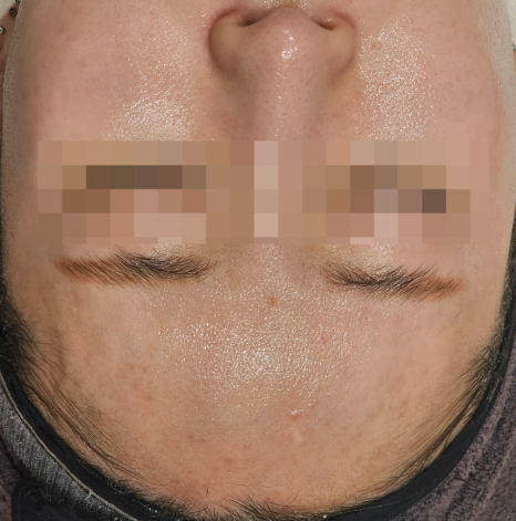 피지메디칼 이미지