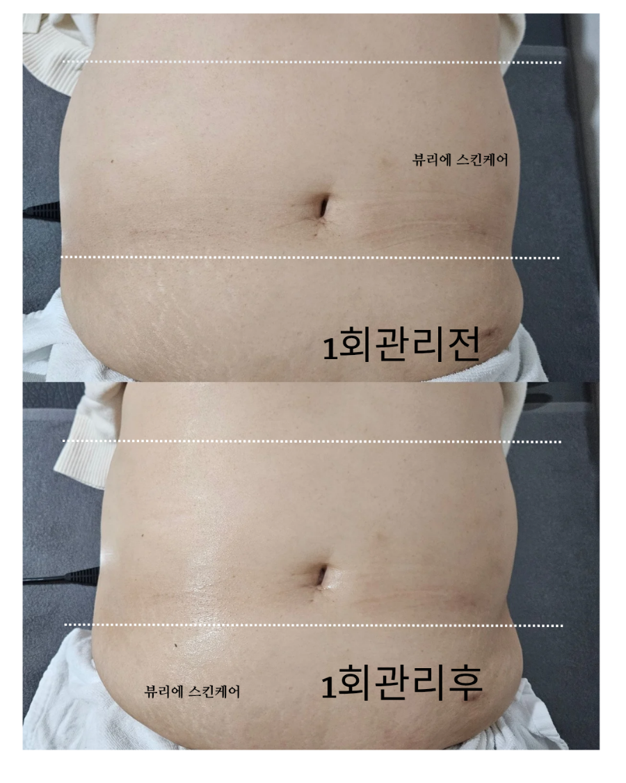 뷰리에스킨케어 이미지