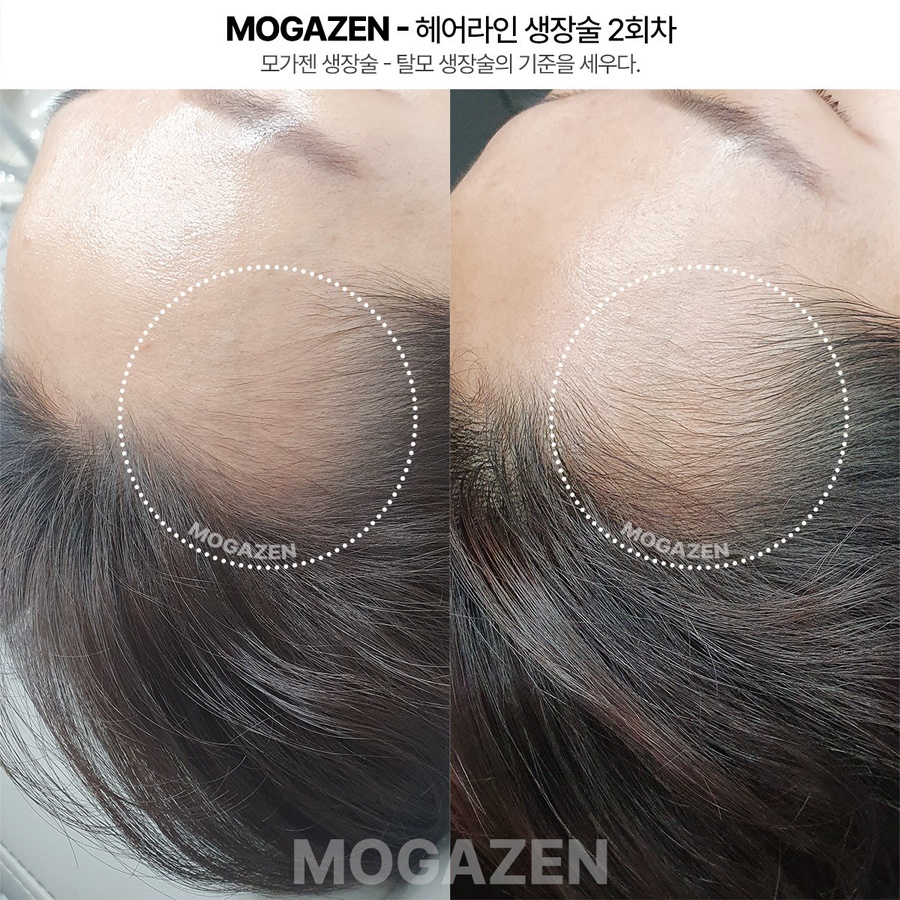 뷰티블링 이미지