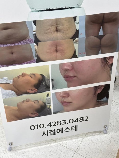 라인에스테 이미지