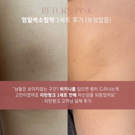 리턴미 이미지