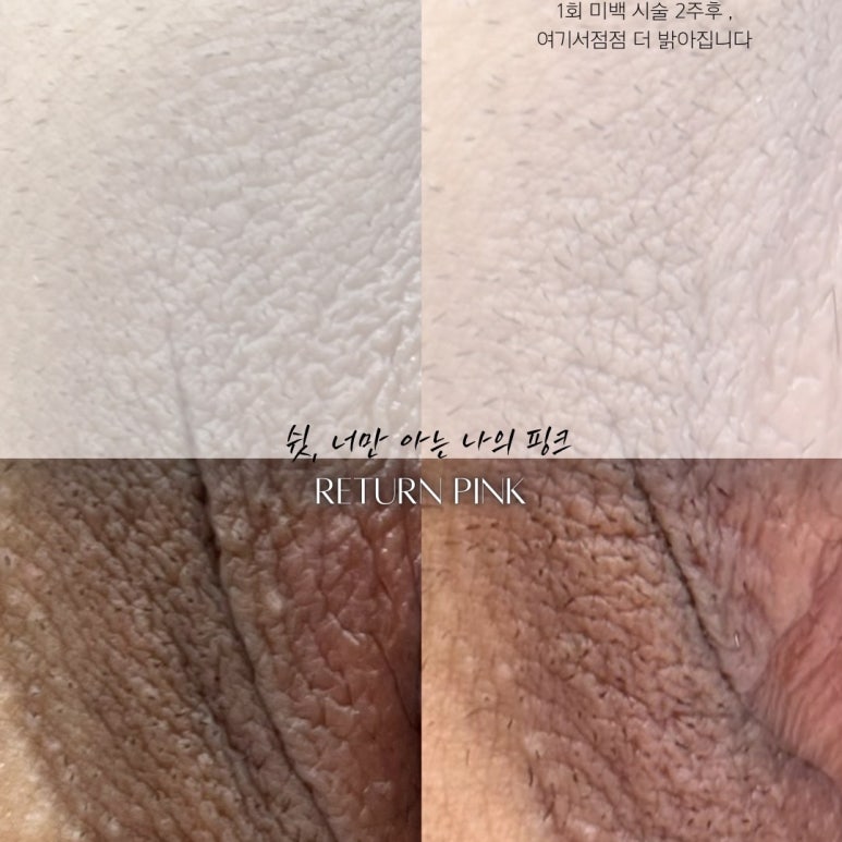 리턴미 이미지