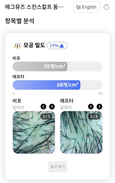 뮤즈힐링케어 이미지