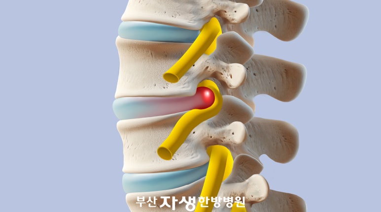 무감각 이미지