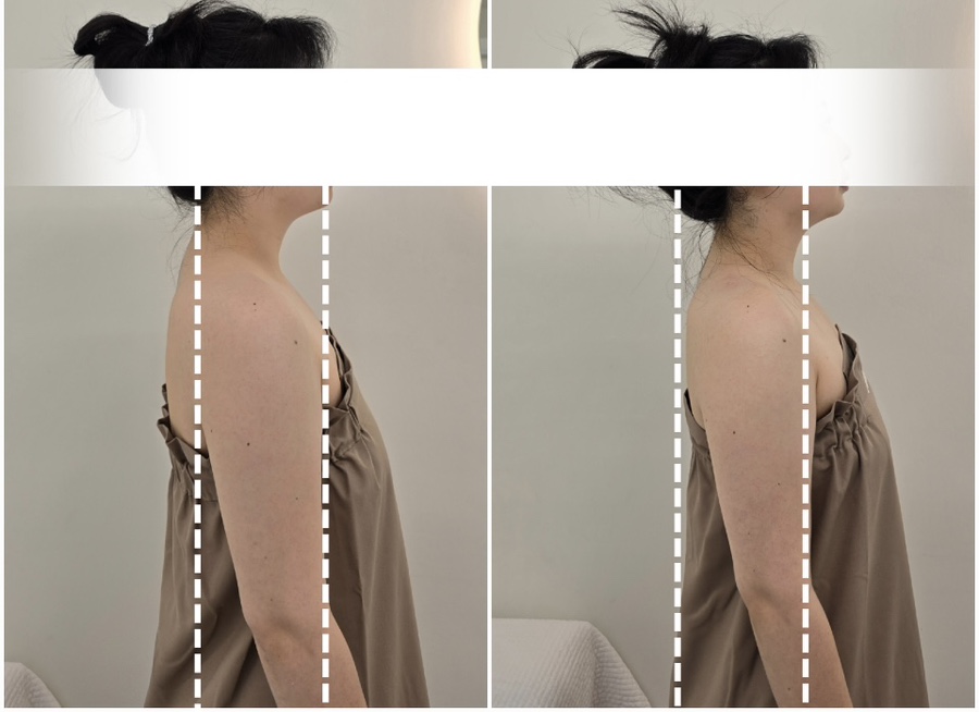 아네스 에스테틱 이미지