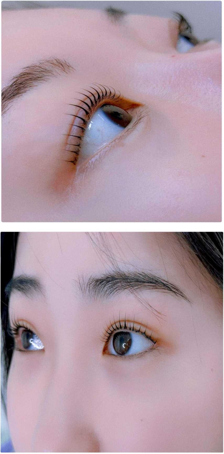 래시베이 이미지