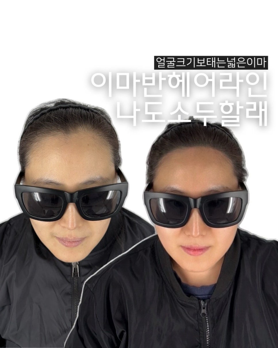 체인지헤어라인 이미지