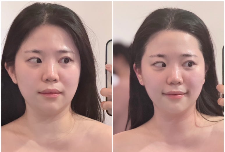 두리스킨케어 이미지