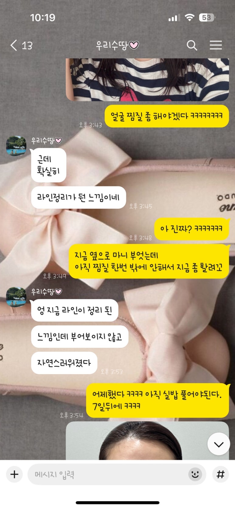 엘팅 이미지