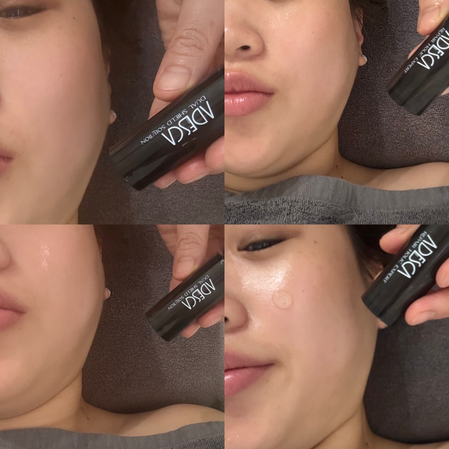 미가스킨케어 이미지