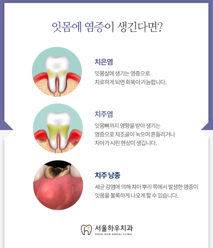 서울하우치과 이미지