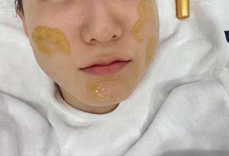 제이비비 이미지