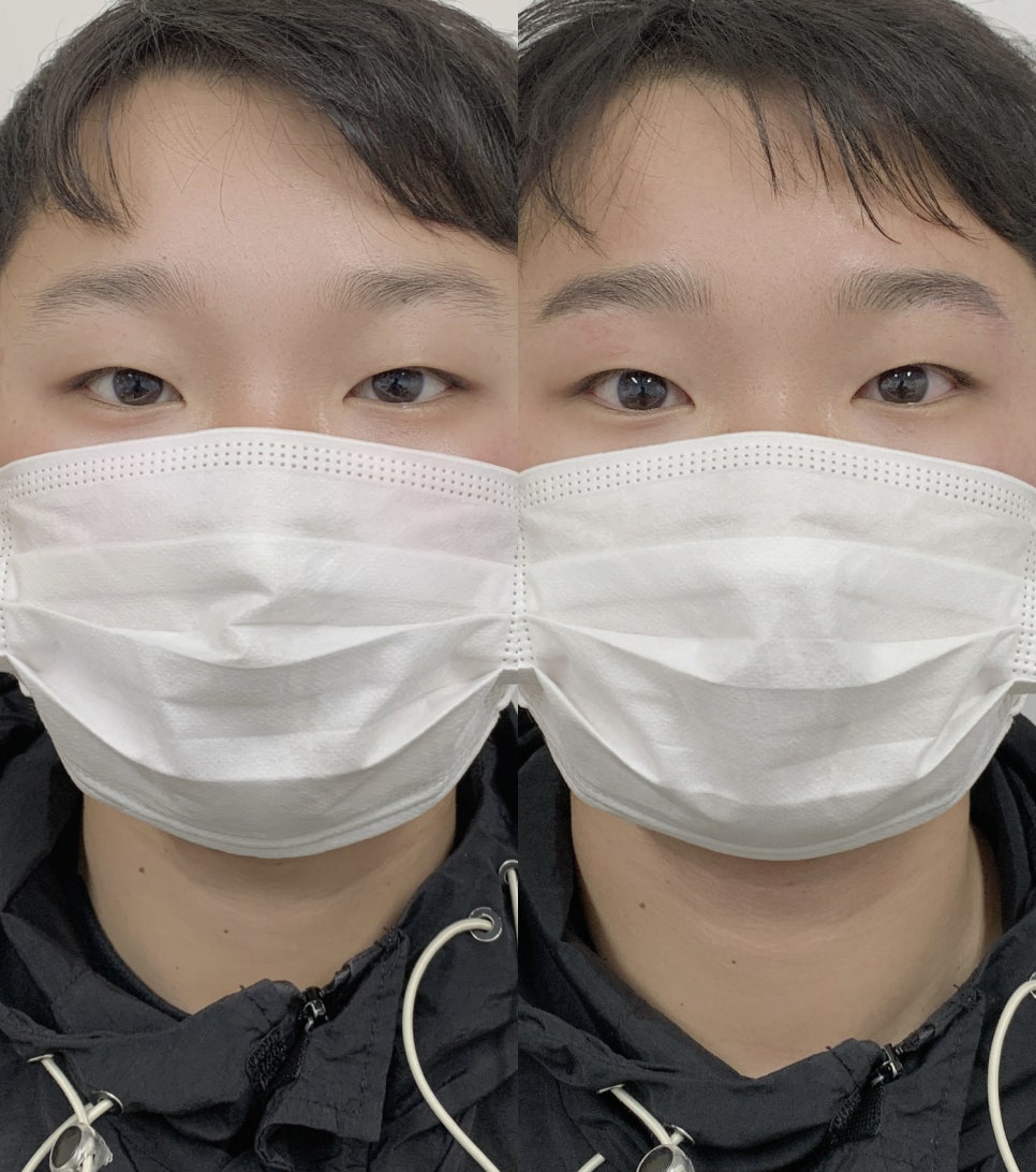토끼눈썹 이미지