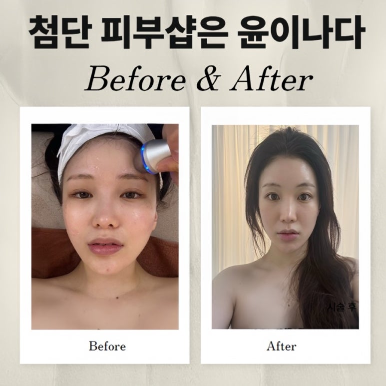 윤이나다 이미지