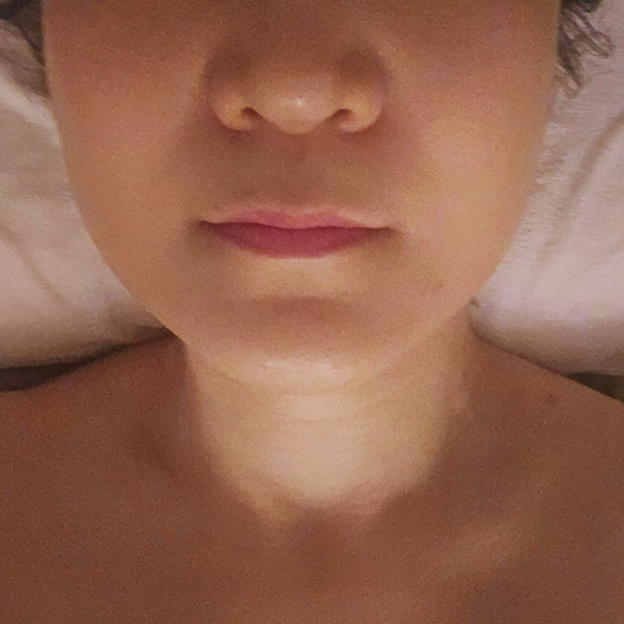 더포레스트스킨 이미지