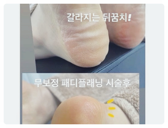 인더블룸 이미지