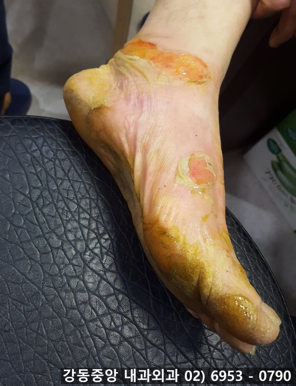 천보성 이미지