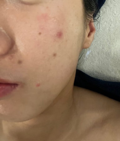 비움채뷰티아비스 이미지