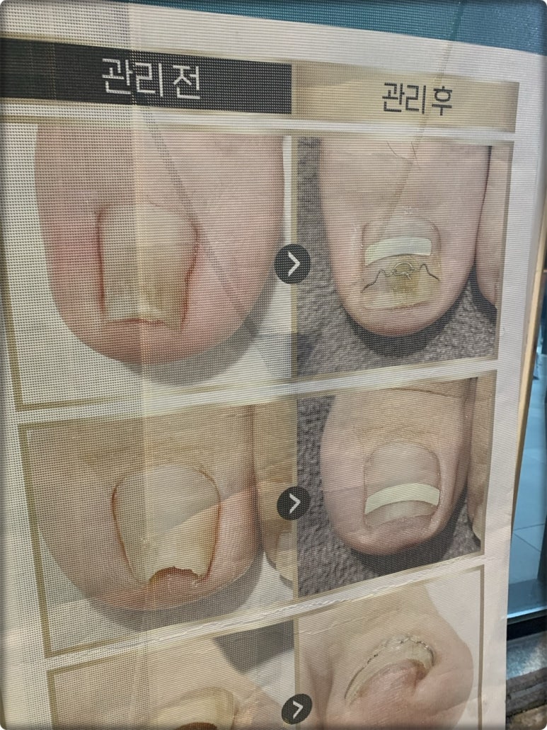 아우룸79뷰티네일 이미지