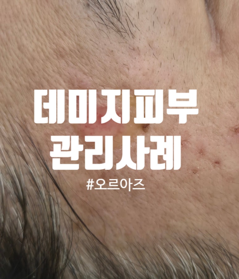 오르아즈 이미지