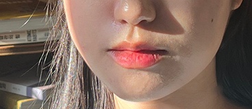 더맑음에스테틱 이미지