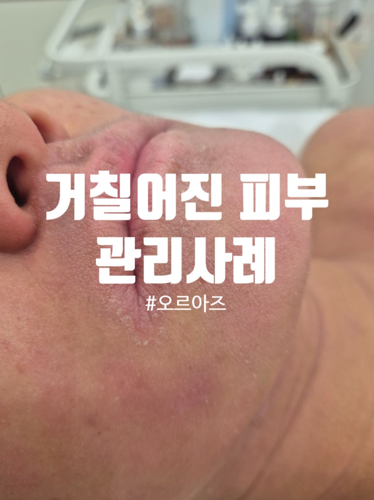 오르아즈 이미지