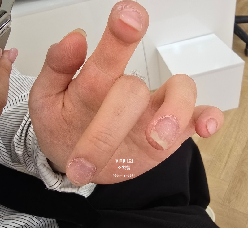 끌리네일 이미지