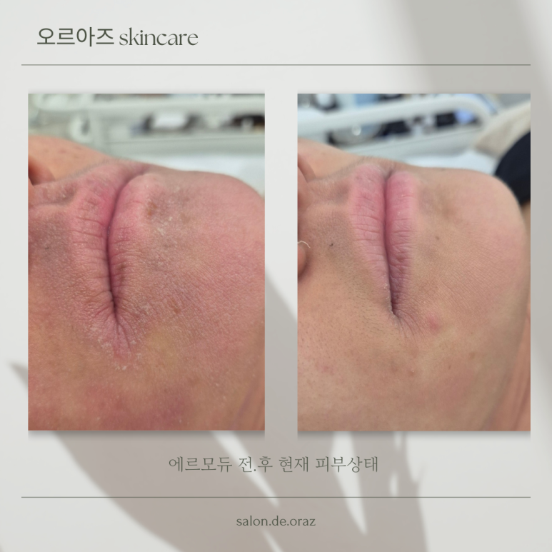 오르아즈 이미지