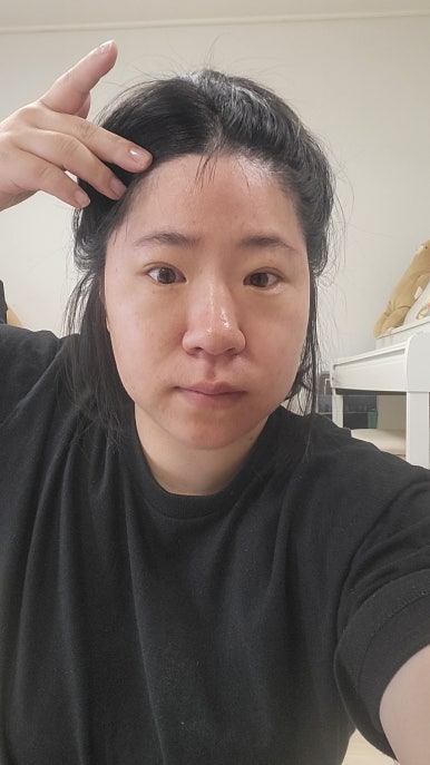 나피부샾 이미지