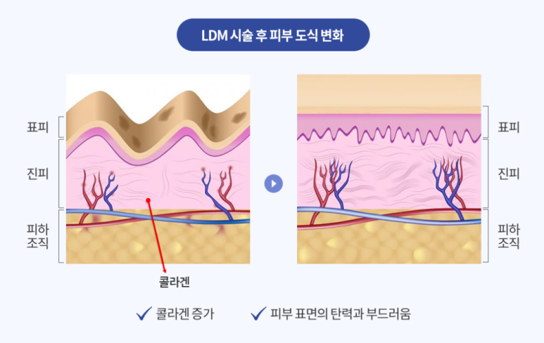 (주)물방울 이미지