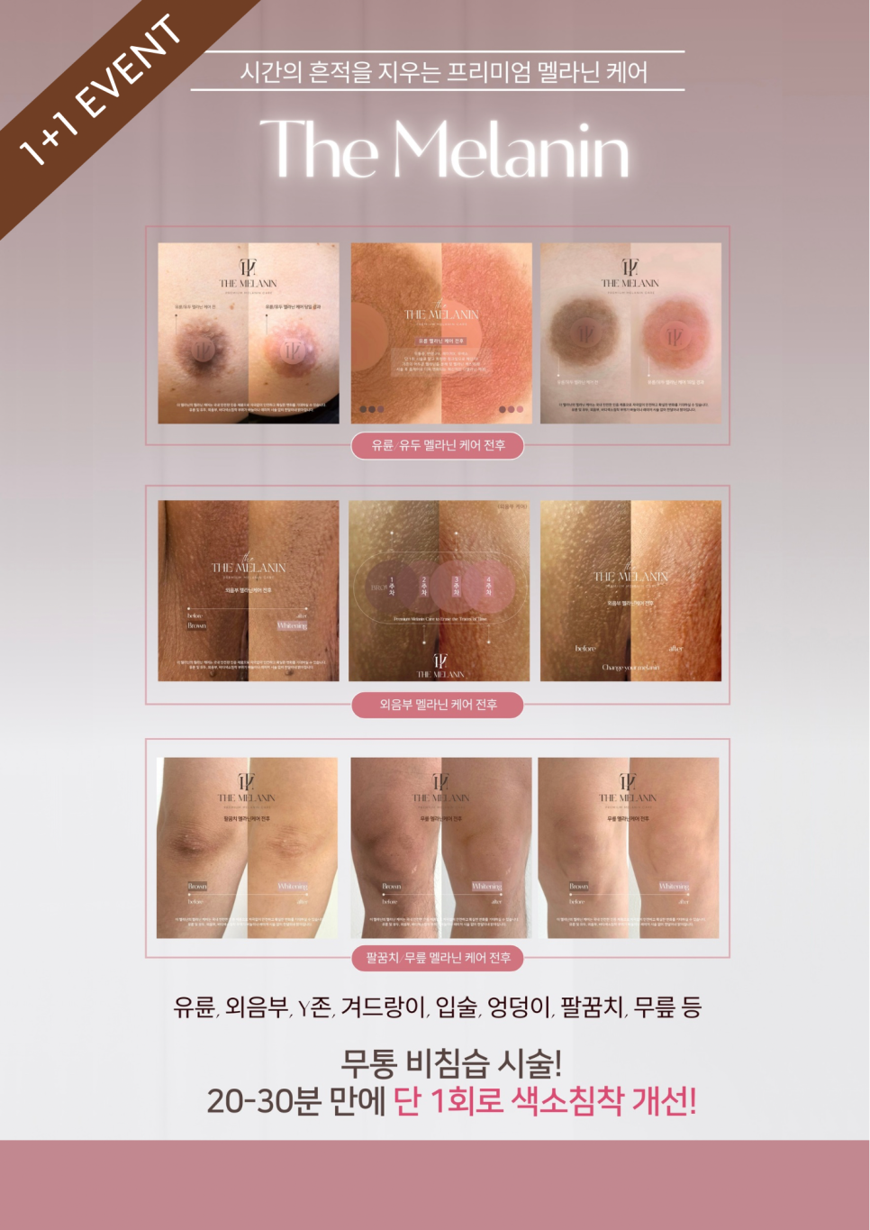 케어샵 이미지