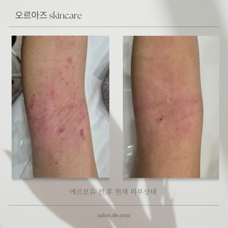 오르아즈 이미지