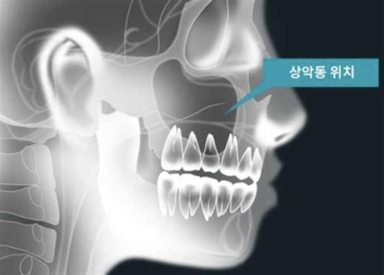 서울하이안치과방배 이미지