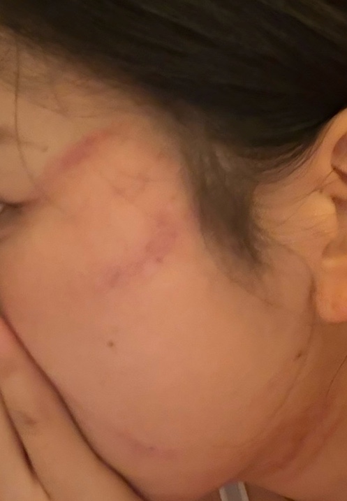강서아이엠유의원 이미지