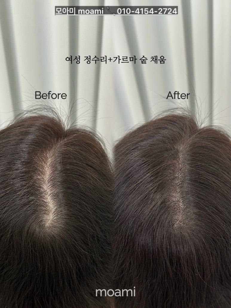 모아미(moami) 이미지