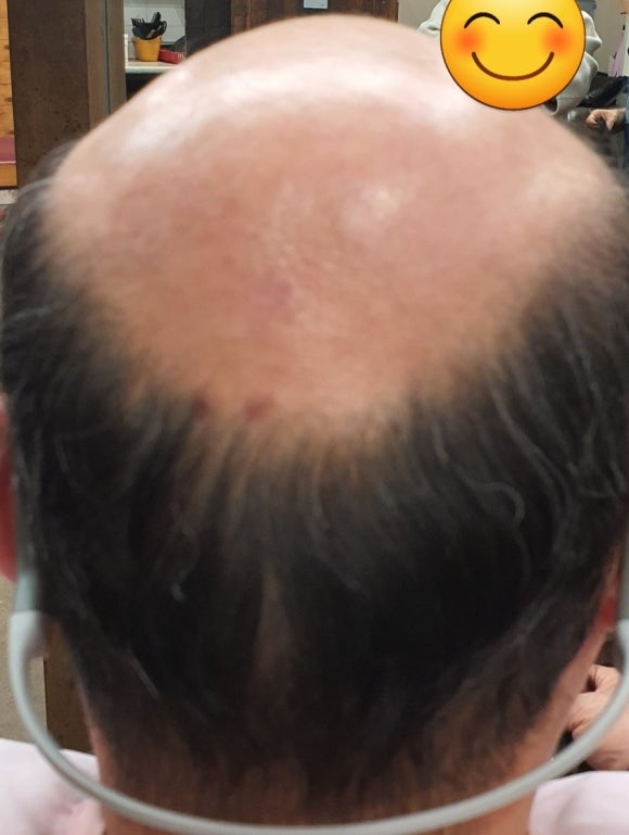 화성미용실김호증모가발 이미지