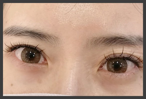 우리토탈케어 이미지
