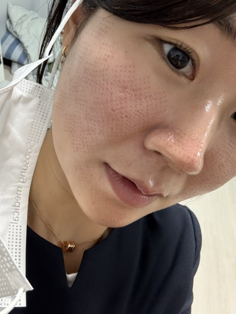 오하이 이미지