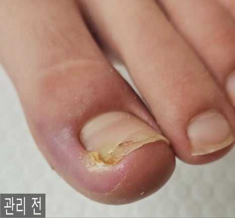 대전레푸스다솜네일 이미지