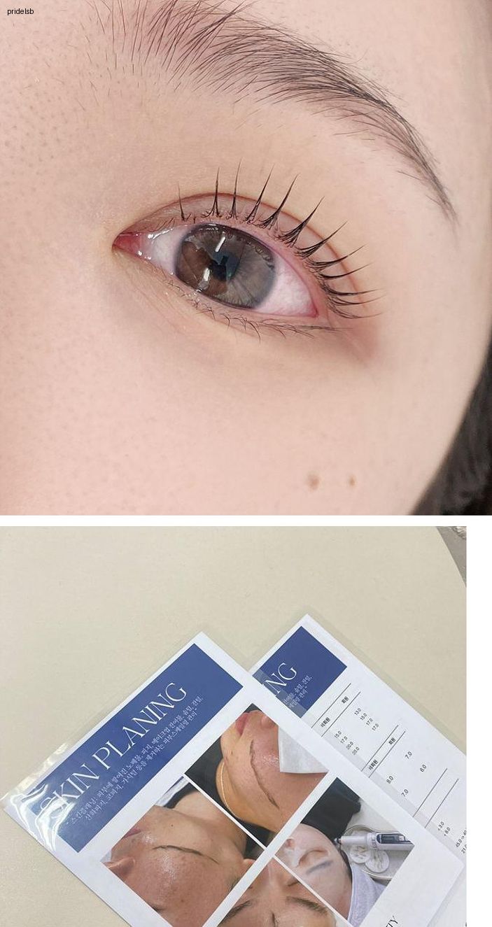 어보브 이미지
