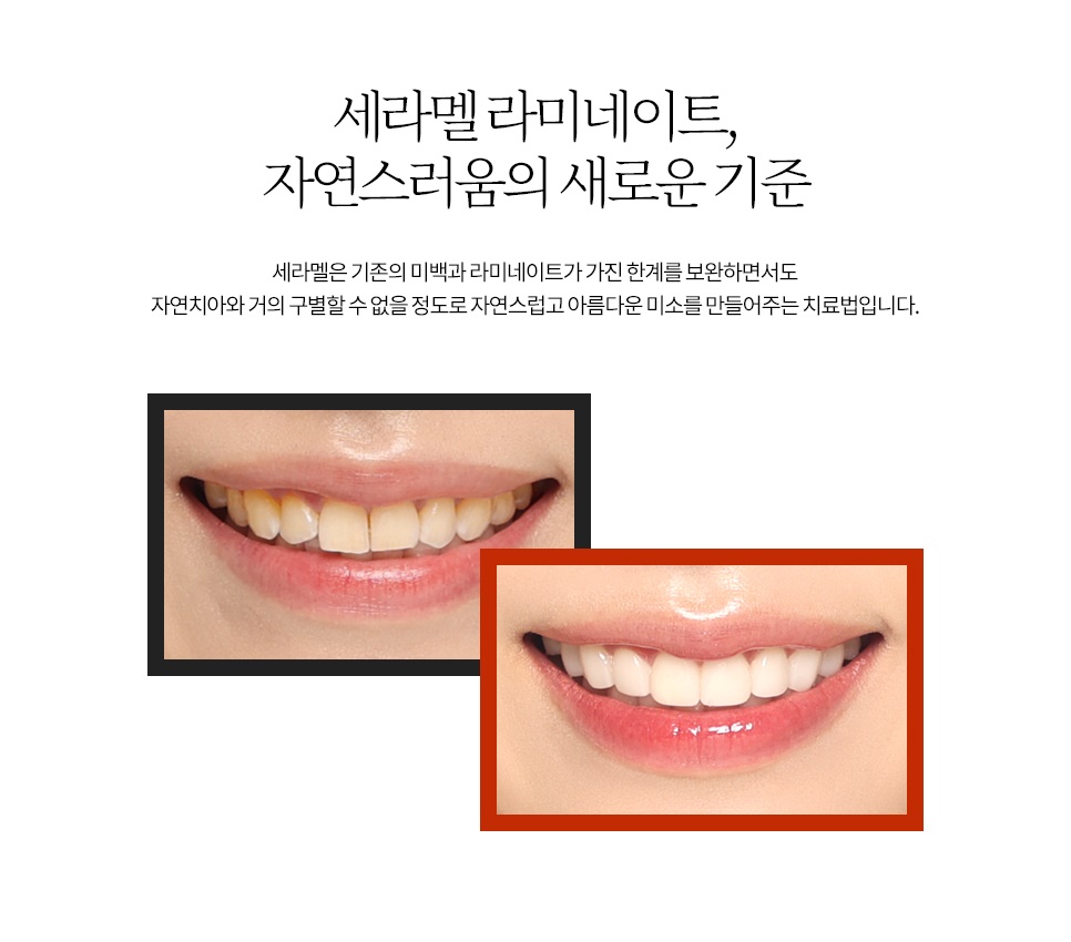 세라덴토 이미지
