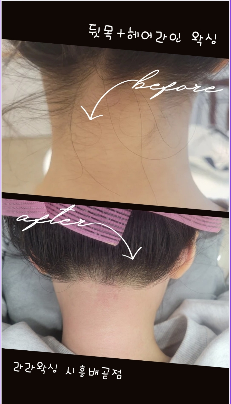권헤어라인 이미지