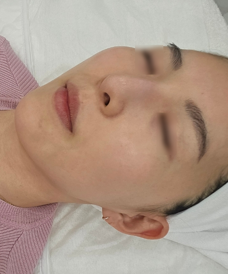 제이비비 이미지