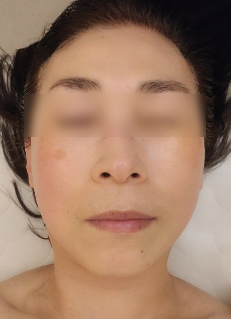 에스테틱베이비페이스 이미지