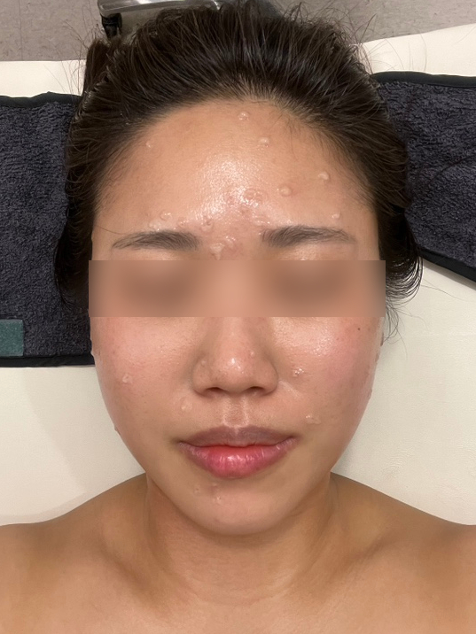 피오니 스킨 앤 바디 이미지